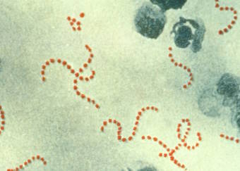 streptococcus-pyogenes